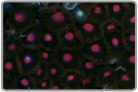 Pink Eye Zoanthids
